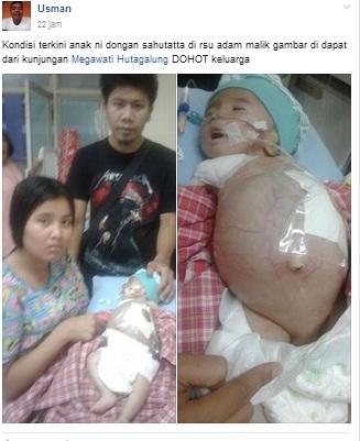 TOLONG !!! Bayi Novel Nababan Butuh Uluran Tangan di RSUP Adam Malik Medan