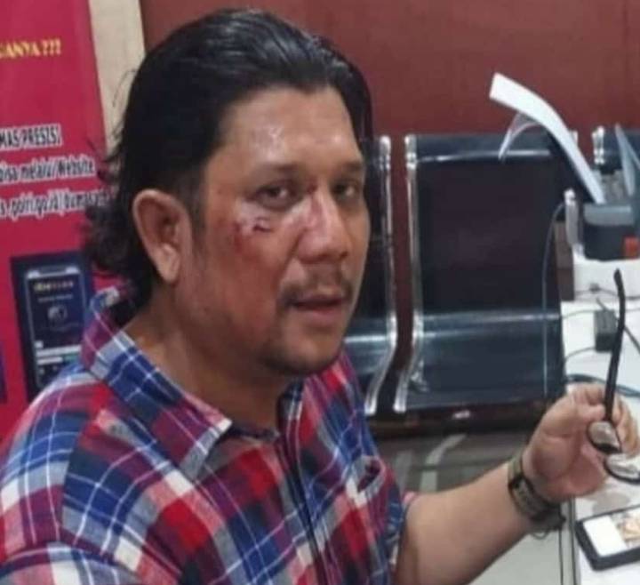 Pernyataan Sikap AJI Medan Terhadap Tindak Kekerasan Pada Jurnalis di Madina