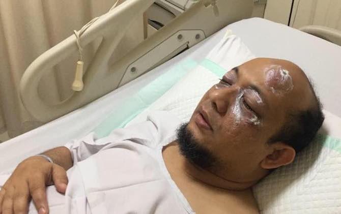 GMKI Wilayah I Sumut-NAD Kecam Tindakan Pembungkaman Terhadap Penyidik KPK