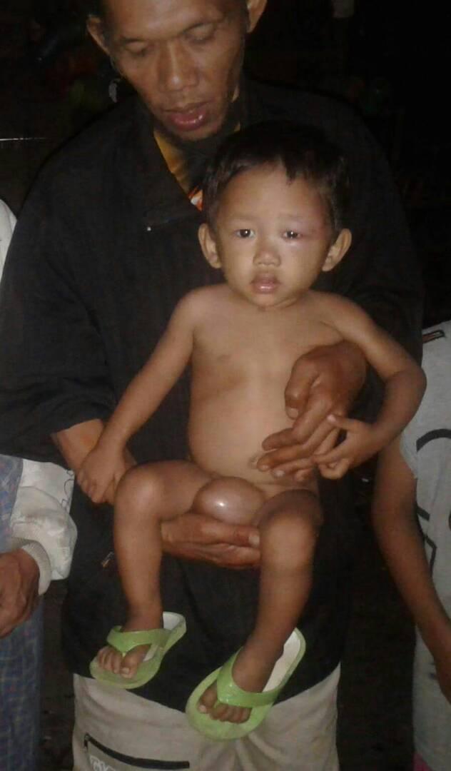 Anaknya Sakit Menahun, Keluarga Siringoringo dari Tarabintang Butuh Bantuan