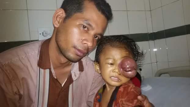 Earlene Annie Kassia Situmorang, Penderita Kanker Mata Butuh Bantuan