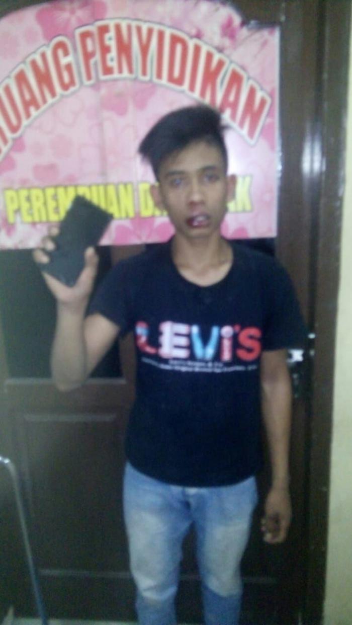 Pria Tanggung ini Rampas HP Milik Robet, Pegasus Polsek Medan Amankan Setelah Bonyok