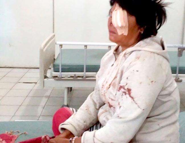 Sadis, Suami Bacok Mata Kiri Istri di Karo