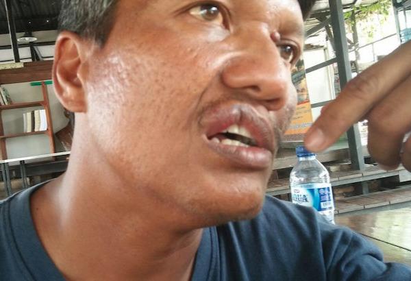Ini Dia Kronologi Kasus Penganiayaan Aktivis Yayasan Pencinta Danau Toba - YPDT) di Samosir Versi Jhohannes Marbun (5)