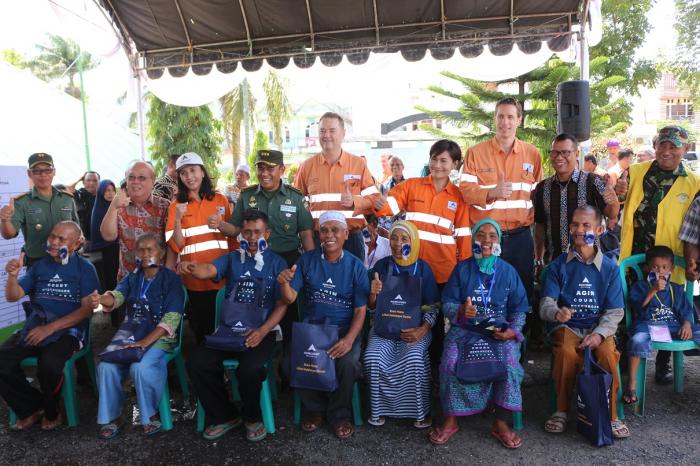 Operasi Katarak Gratis Tambang Emas Martabe Selamatkan  908 Mata