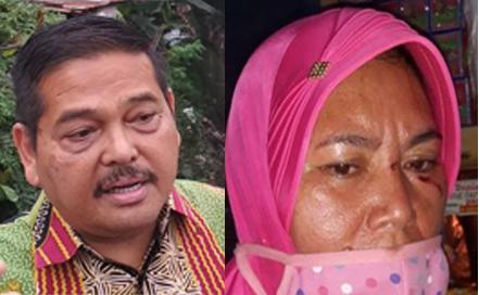 Marnelia Boru Purba Alami KDRT, Anggota DPD RI Minta Pelaku Ditindak Tegas
