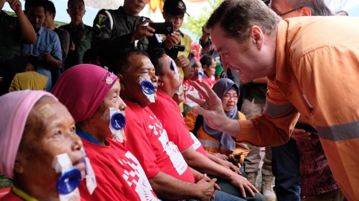 Operasi Katarak Tambang Emas Martabe Sukses Kembalikan Penglihatan 1.123 Mata