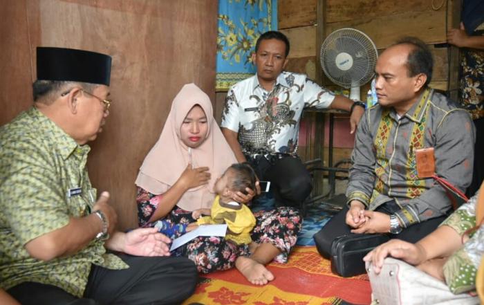 Pemko Padangsidimpuan Sambangi Balita Suspek Gizi Buruk