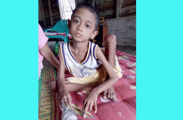 Tolong, Habibi Idap Penyakit Infeksi Darah di Labuhanbatu