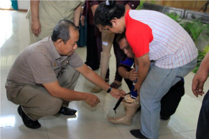 Hari Disabilitas Internasional, Kaki Palsu dan Alat Bantu Dengar untuk Mereka