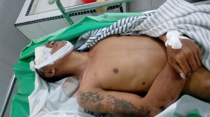 Ngeri, Pelaku Jambret Tewas Dimassa